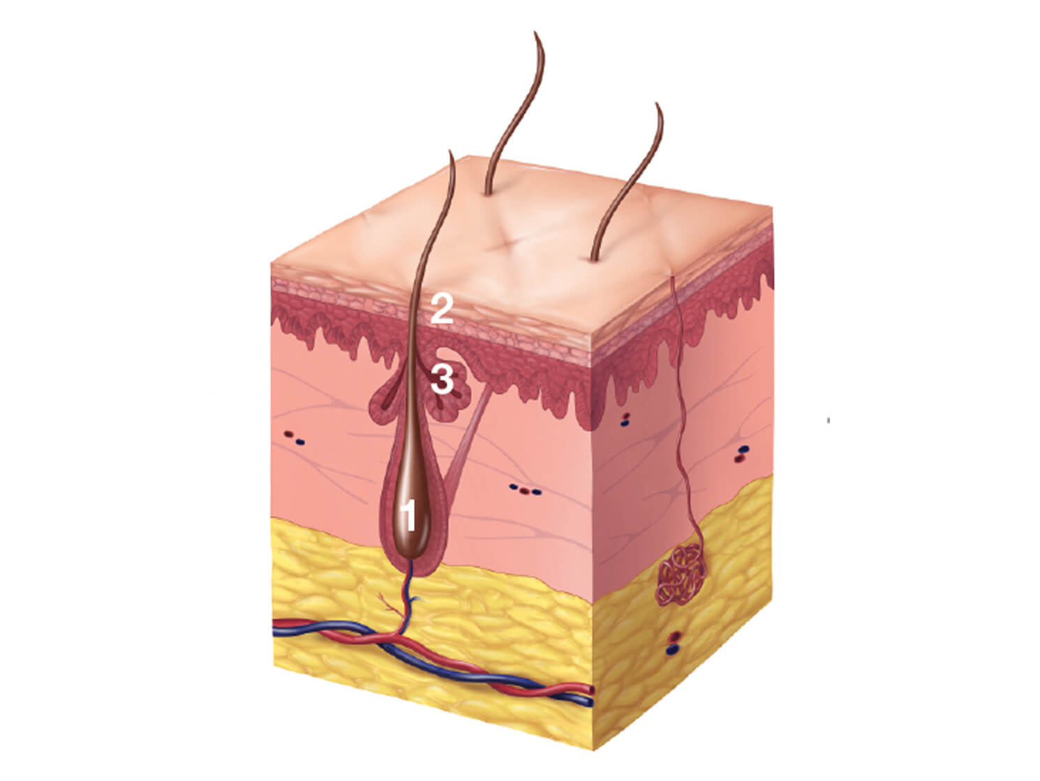 Illustration of a normal follicle