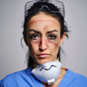 Face showing damage from Personal Protective Equipment